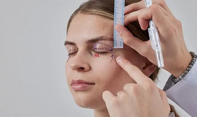 Sarkan Göz Kapakları: Estetik Bir İhtiyaç mı,   Yoksa Ciddi Bir Görme Sorunu mu?